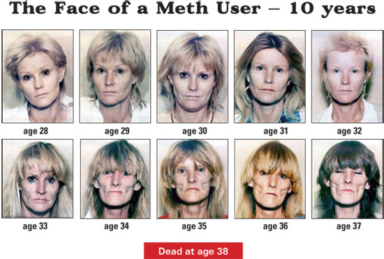 Meth Lady Images